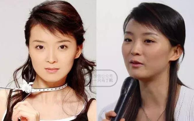 俞飞鸿颧骨抗老,高颧骨俞飞鸿