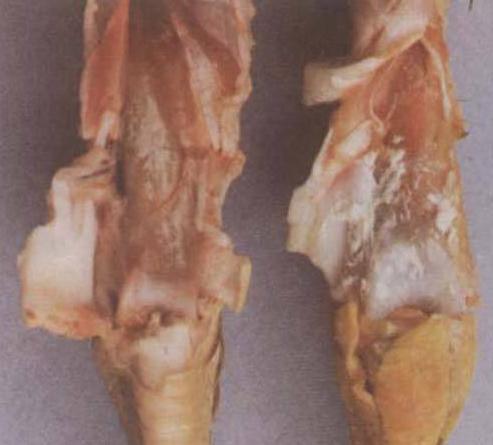 如何诊治鸡的痛风病呢,鸡痛风病怎么引起的