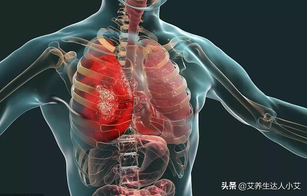 喉咙呼噜噜的痰音可预示五种疾病,什么样的痰预示有疾病