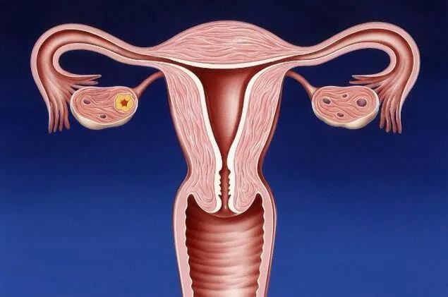 女孩第一次做妇科检查,女性第一次做妇科检查注意事项