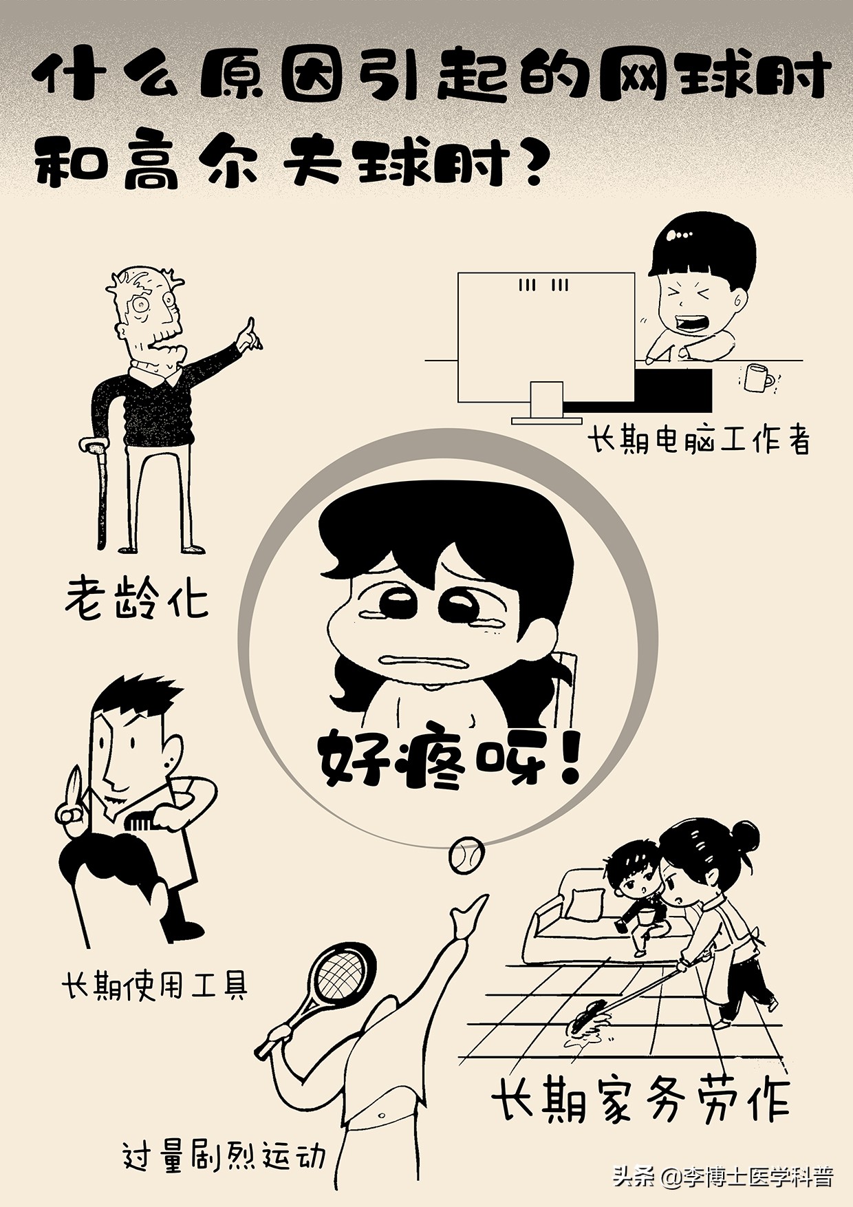 网球肘和高尔夫球肘会同时得吗,网球肘和高尔夫肘如何防治