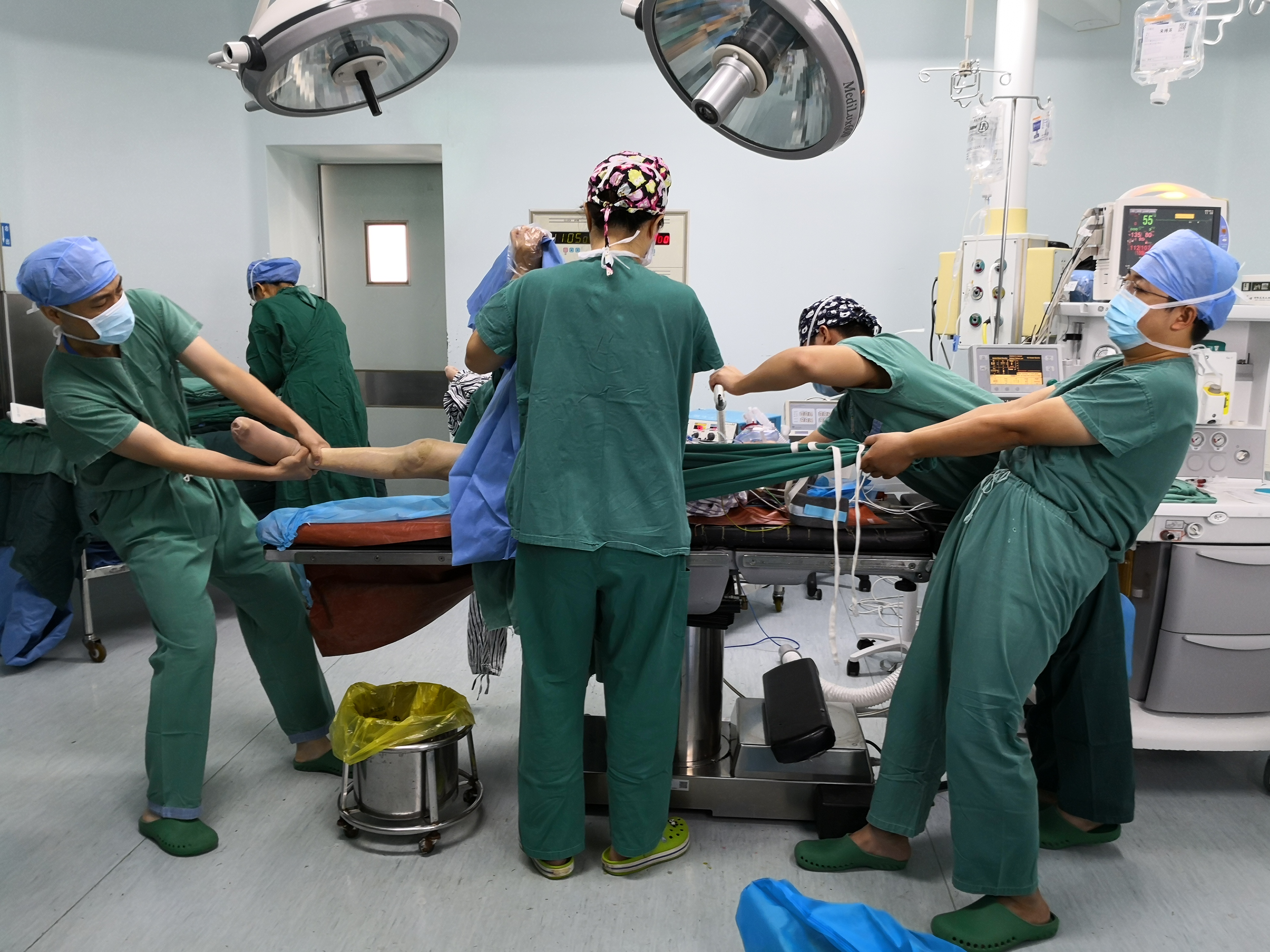 老人一屁股摔倒脊柱骨折如何治疗,老人一屁股坐地上怎么处理