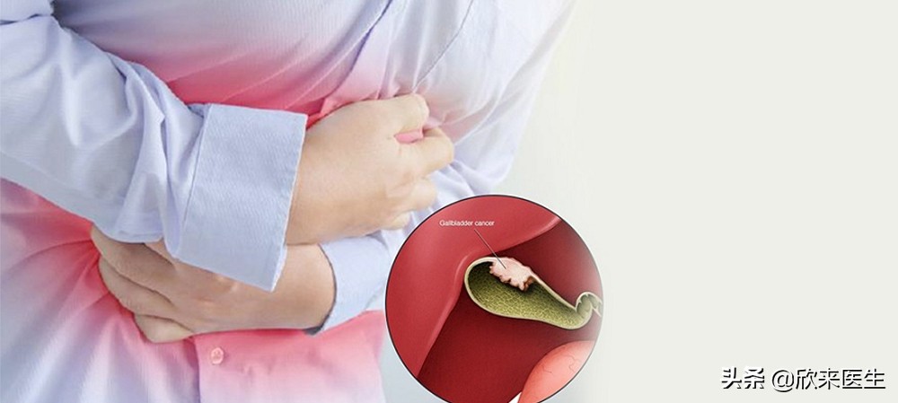 公务员入职体检胆囊息肉有影响吗,胆囊息肉要紧吗影响公务员体检吗