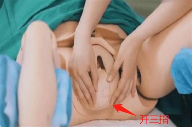 你以为生孩子最痛的是分娩吗,你以为的剖腹产实际的剖腹产