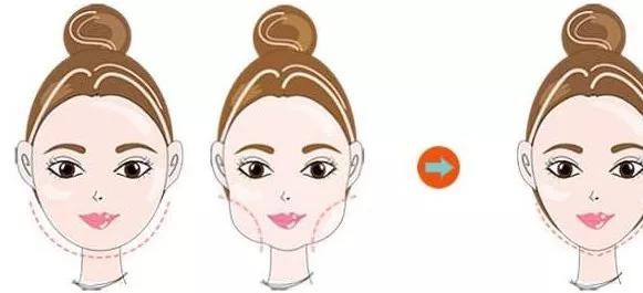 面部咬肌肥大怎么去除,脸部咬肌怎么消除整形