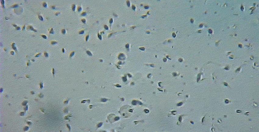 为什么精子会以蝌蚪的形式存在,科学家首次发现精子运动
