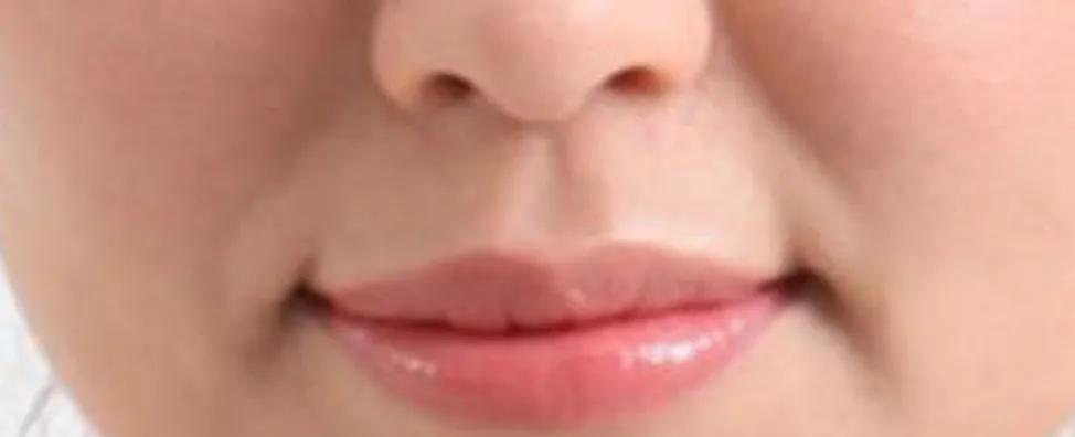 年纪轻轻有法令纹咋办,年纪轻轻就有法令纹怎么办