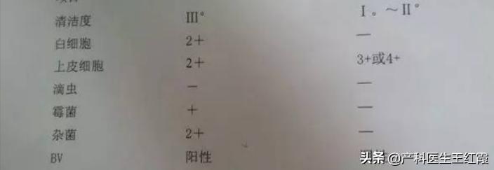 白带增多、脓性灰黄色伴豆渣样、霉菌性阴道炎真的是“发霉”了吗