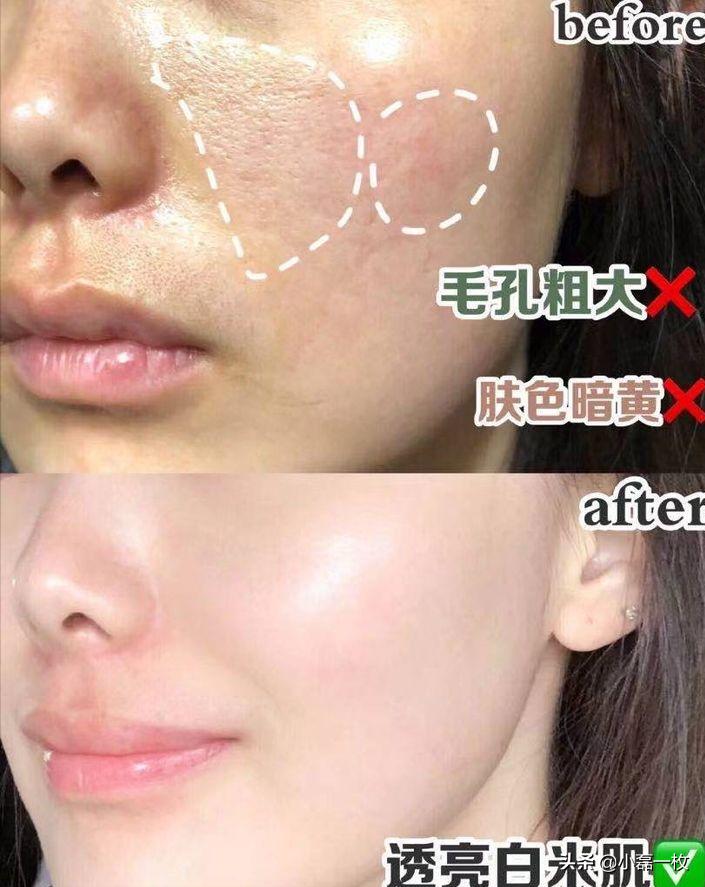 熬夜脸蜡黄暗沉怎么调理,经常熬夜脸色蜡黄喝什么汤水调理