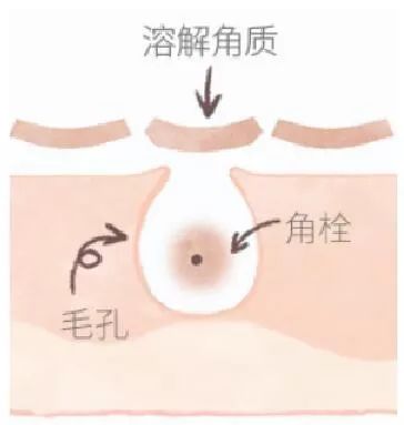 城野医生毛孔细致焕活精华水测评,城野医生毛孔收敛水使用步骤