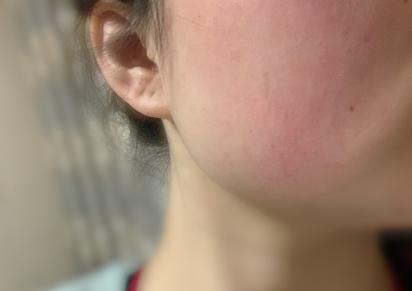 如何根据不同肤质挑选护肤品呢,角质层薄混合肤质用什么护肤品