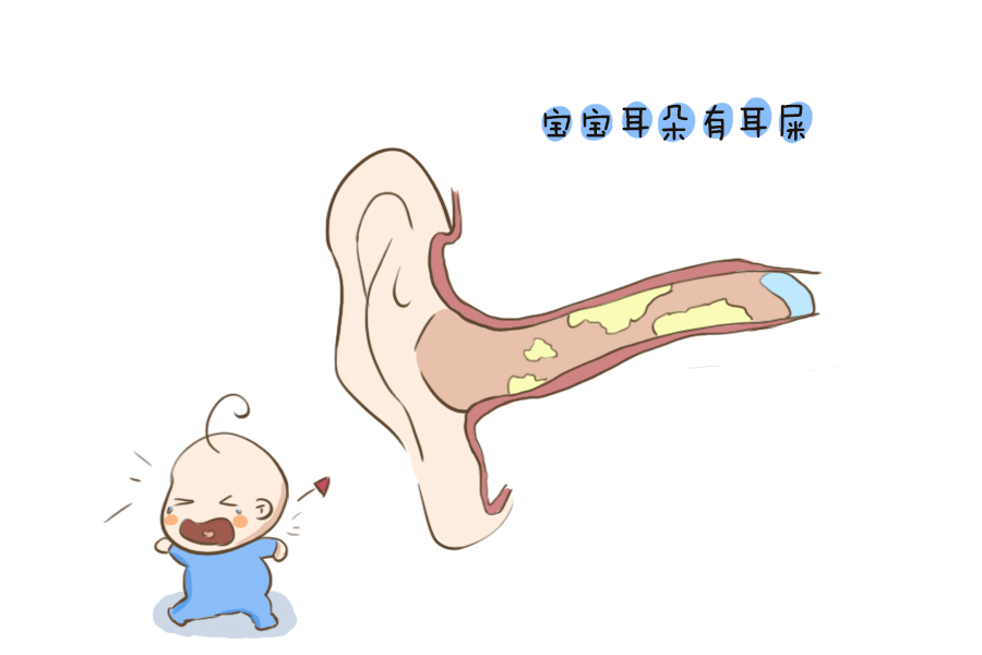 宝宝耳朵里很多耳屎到底掏不掏,宝宝耳朵有耳屎怕不让掏怎么办