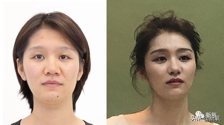 村姑整成鞠婧祎的鼻子变天使,鞠婧祎的鼻子整过吗