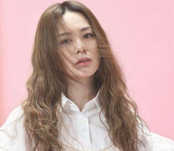 阿娇头部受伤缠绷带照曝光,阿娇受伤后拆绷带首露面