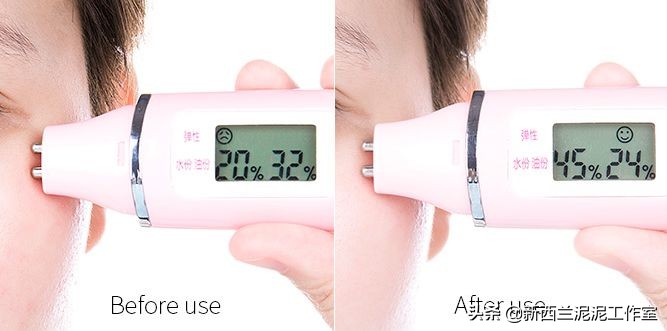 吴昕同款祛黄脸,吴昕眼袋