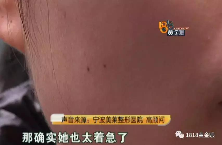 打完瘦脸针青蛙腮正常吗,打完瘦脸出现青蛙腮