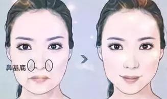 年纪轻轻有法令纹咋办,年纪轻轻就有法令纹怎么办