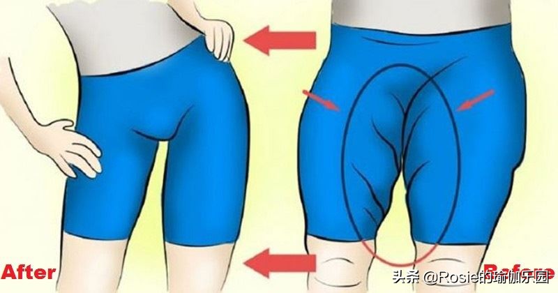 大腿外侧粗壮肌肉腿怎么减,大腿内侧松外侧紧怎么练习