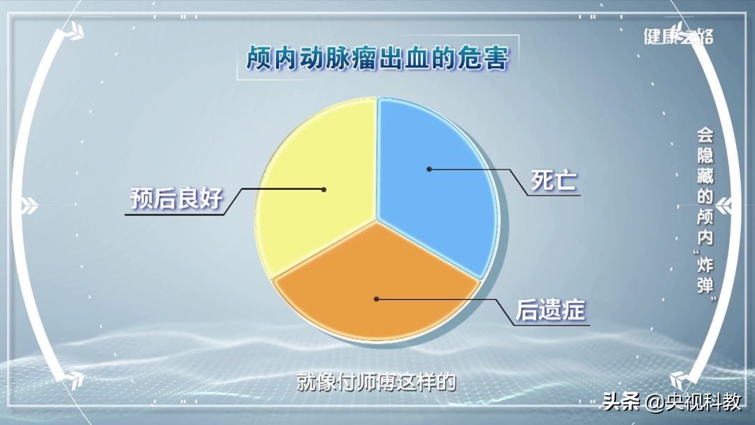 脑动脉瘤能吃腌制食品吗,过度食用腌制食品