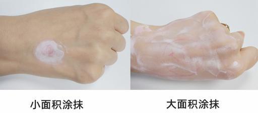 炉甘石治疗手痒正确用法,炉甘石洗剂老年人瘙痒