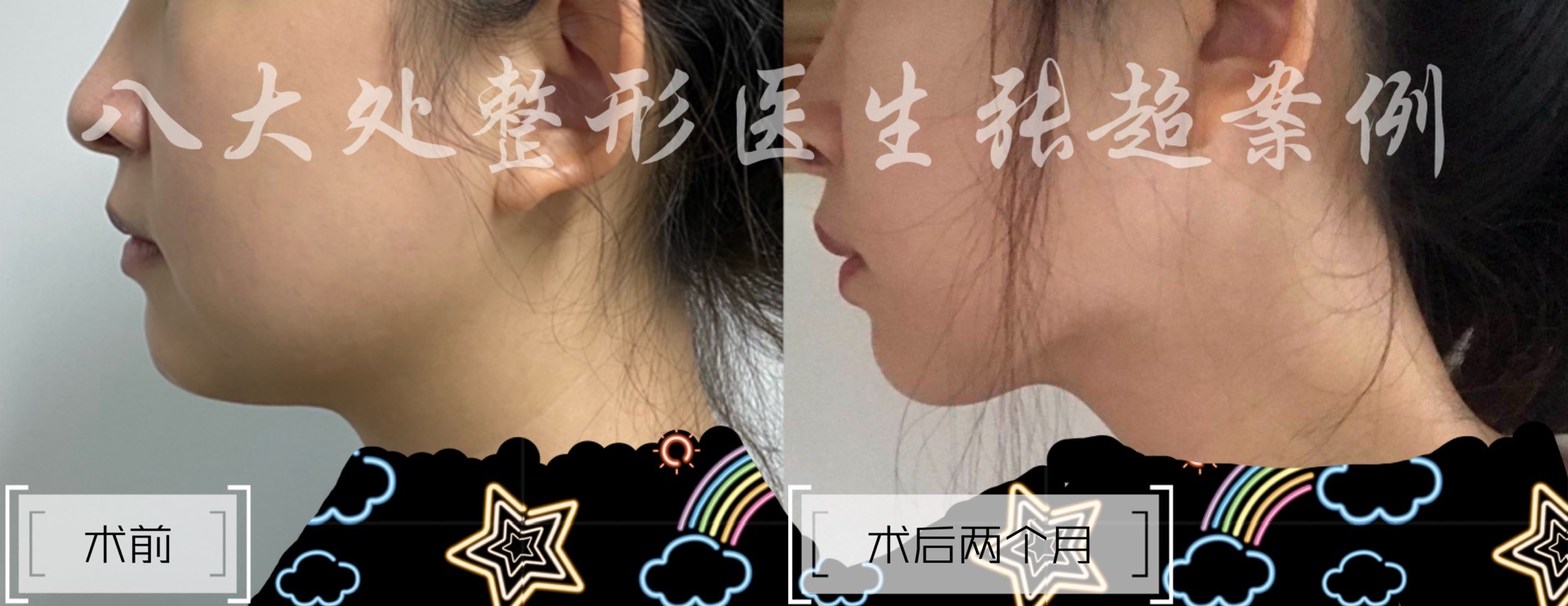 八大处整形张超,八大处张超最新视频