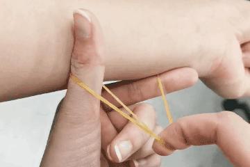 光子嫩肤和超光子有什么区别,光子和光子嫩肤有什么区别