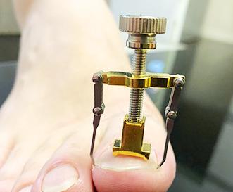 常见脚病图解最新版,各种脚病的科普视频