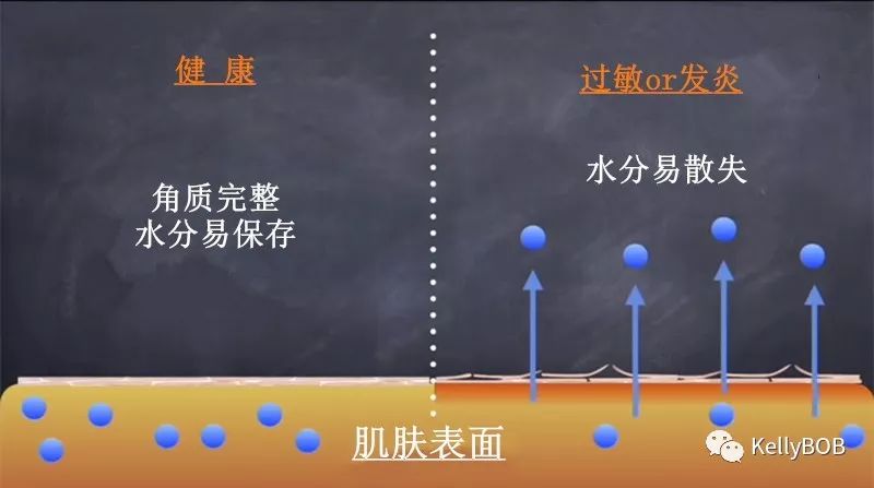 肌肤最近在过敏建议如何解决,三个护肤误区让皮肤越来越敏感