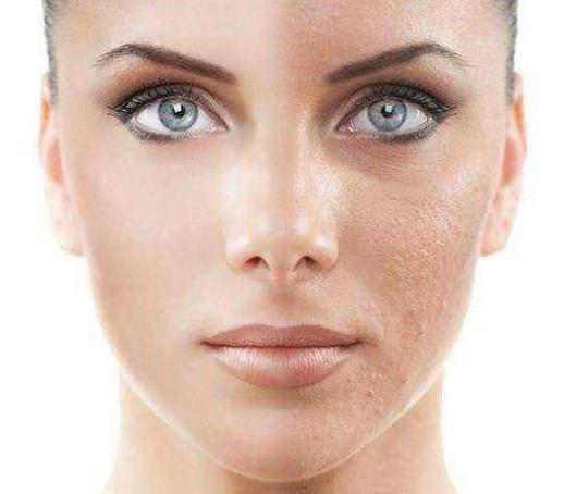 想让皮肤变白做什么美容,想让皮肤变白变嫩