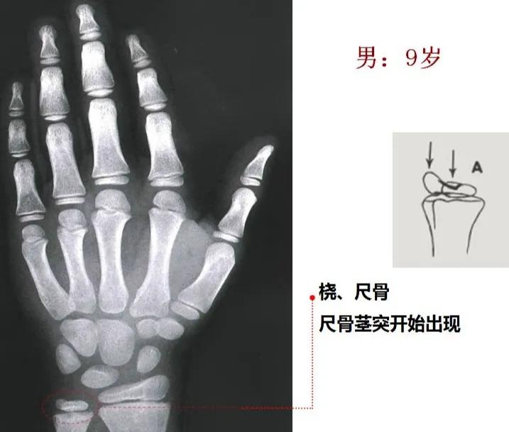 孩子个子高却跑不快,孩子个头不高怎么办