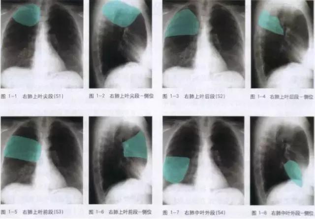 休闲小白鞋夏,献血小板相当于献血多少