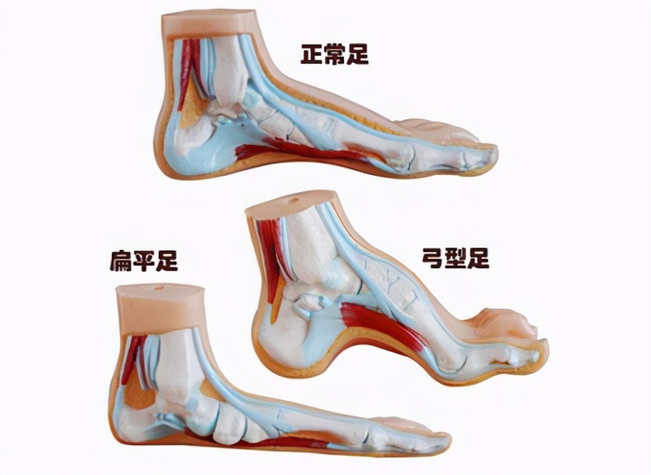 好久不活动一锻炼就膝盖疼,膝盖运动就疼休息就好