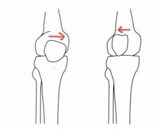 膝关节咔咔响隐隐作痛,下蹲时膝关节有小咔咔声