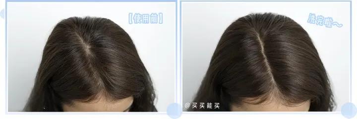 鞠婧祎全身造假,鞠婧祎头皮都整了吗