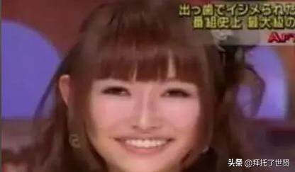 石原里美和佐藤健,石原里美整容之路