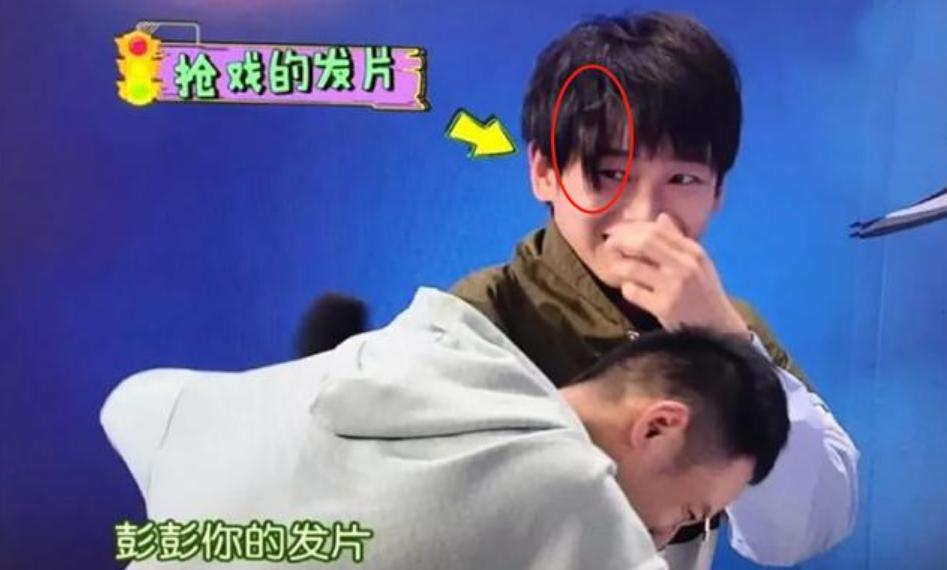 26岁鞠婧祎、彭昱畅都有脱发困扰？提高头皮密度的速效护理