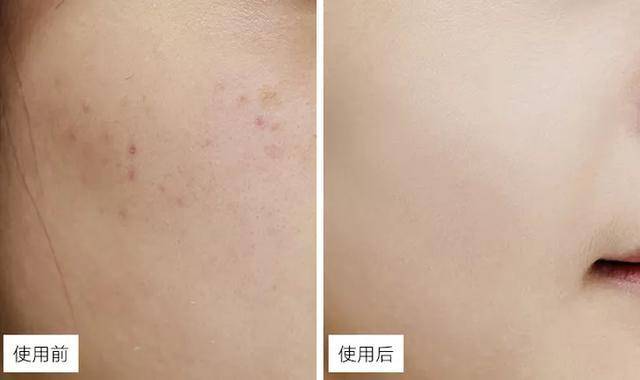 护肤国货片仔癀,护肤化妆品片仔癀