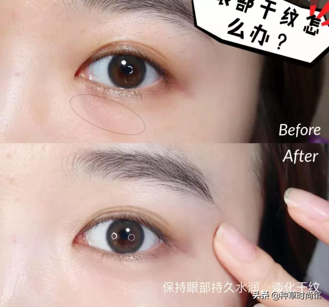 眼霜是不是越贵越好,眼霜越贵越好吗