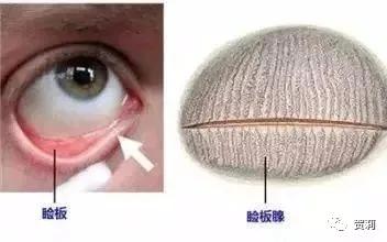 眼睛发干发涩发胀什么原因,眼睛发涩疲倦头发胀是怎么回事