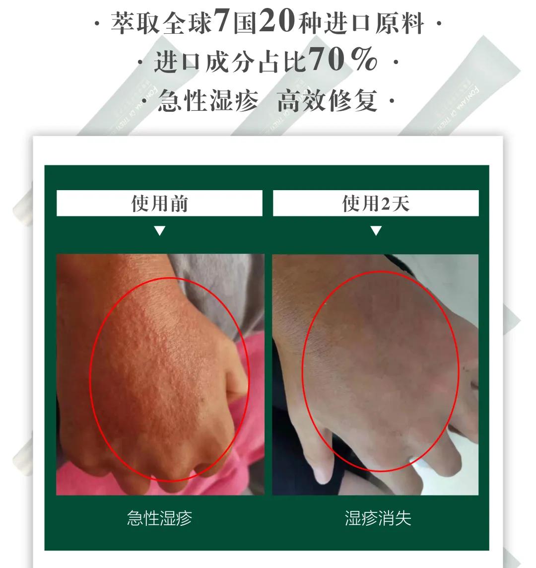 肌肤发红发痒怎么护理,泛红刺痛干痒如何修复