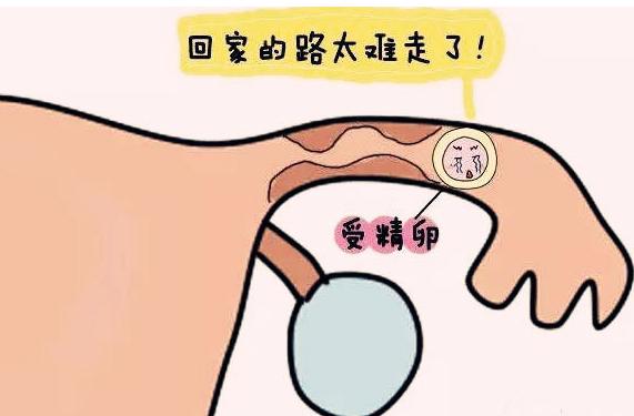 女人宫外孕一般是什么原因造成的,女性宫外孕是不是代表双方都正常