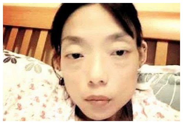 为嫁豪门穿了30年瘦身衣,22岁嫁入豪门减肥暴瘦44斤