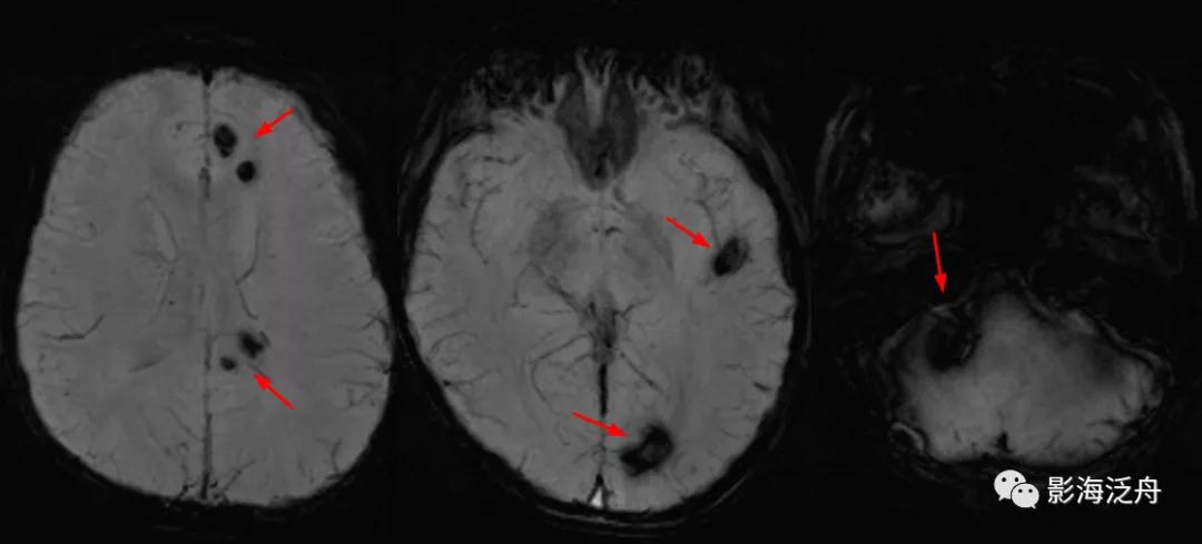 棰呰剳纾佸叡鎸痙wi搴忓垪,棰呰剳dwi搴忓垪鏈鏄庢樉寮傚父