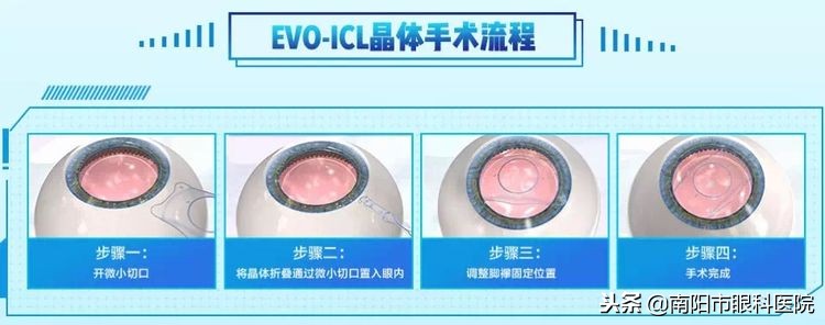 南阳眼科医院张春梅主任,张春梅眼科