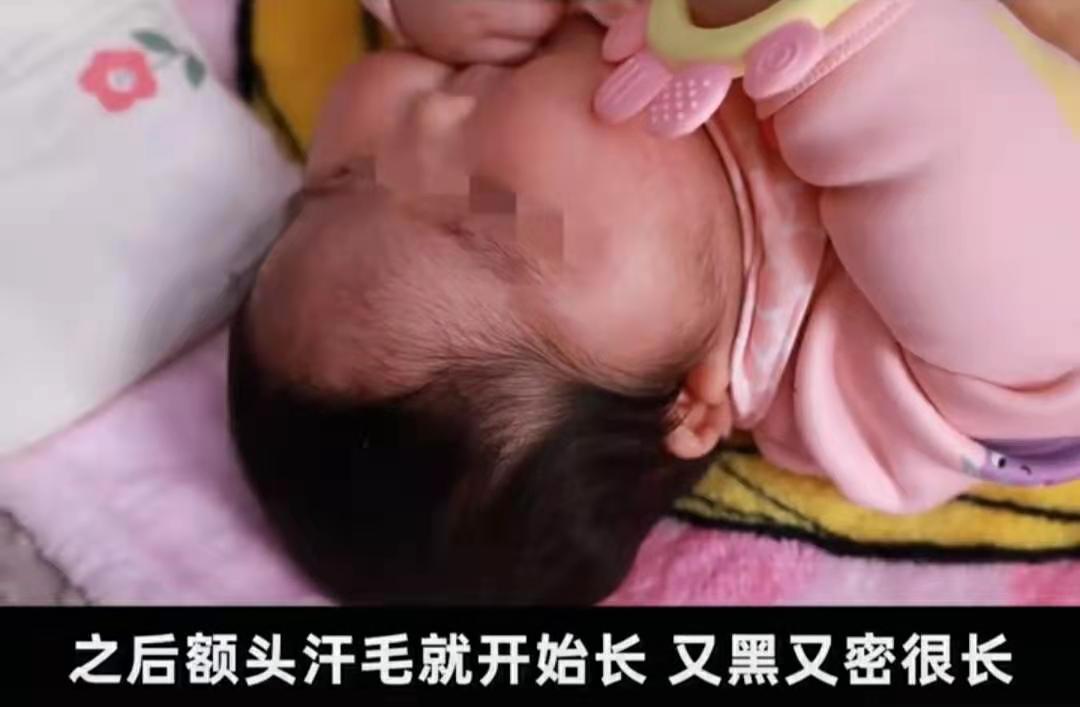 用婴儿面霜额头会长毛吗,婴儿六个月额头上长汗毛