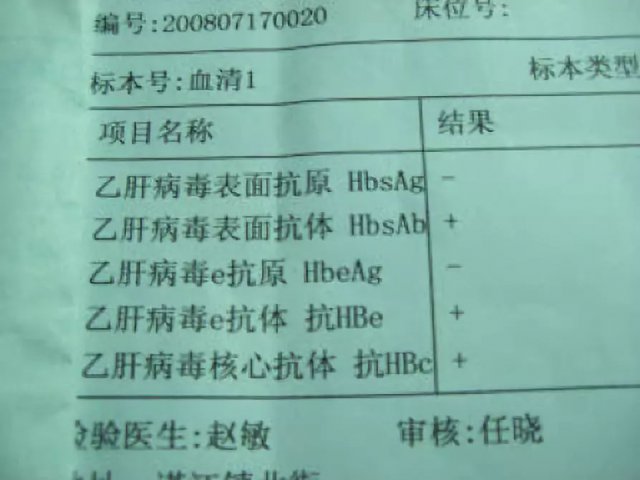 乙肝传染性极强,乙肝患者怎么克服焦虑恐慌心理