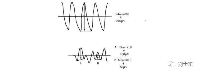 脑电图基础知识入门,脑电图基础知识讲解