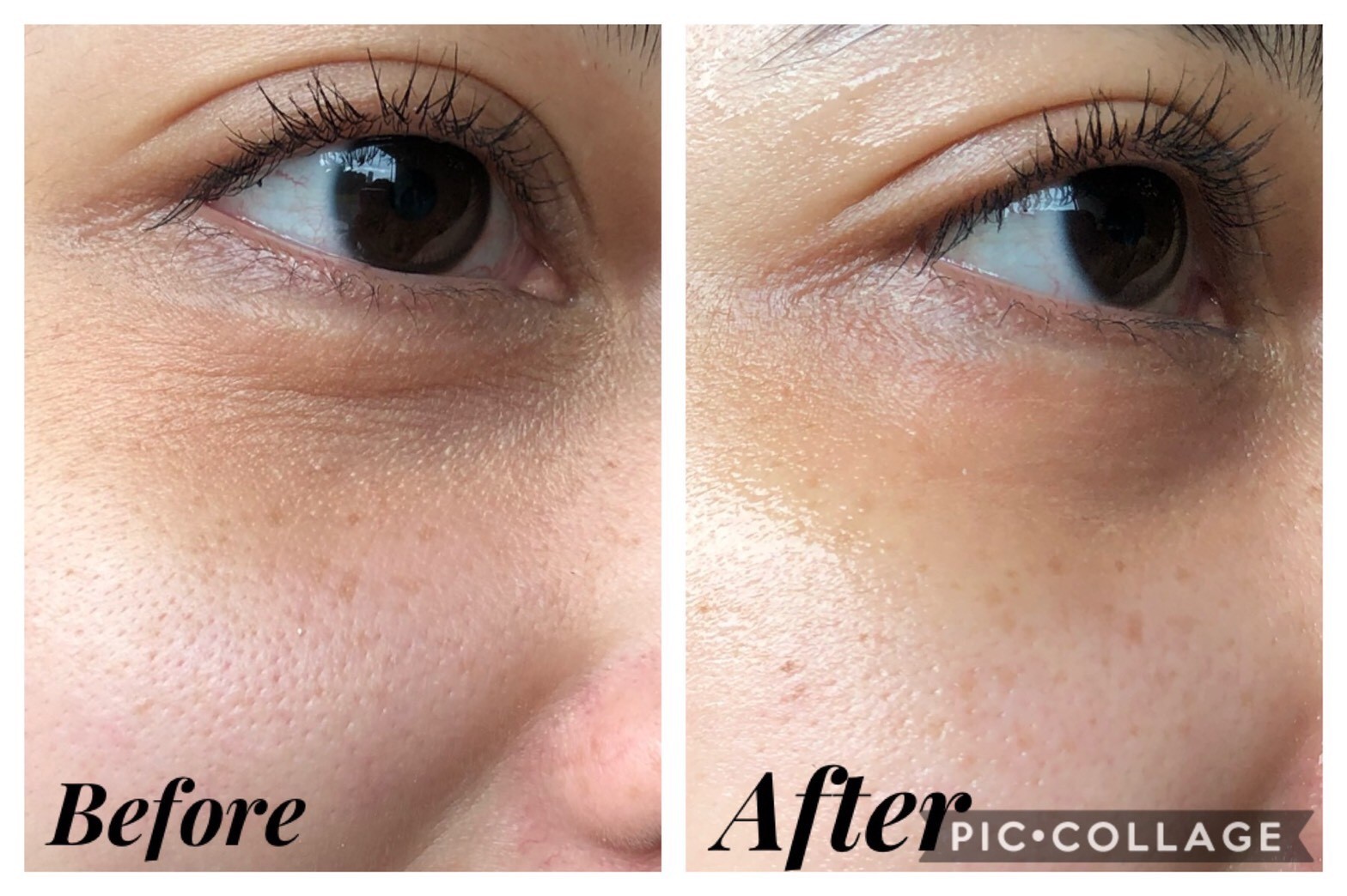 肌肤急救的面膜,肌肤快速修复用医用面膜