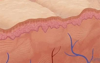 激光治疗疤痕增生需要多少钱,激光治疗疤痕费用一般多少