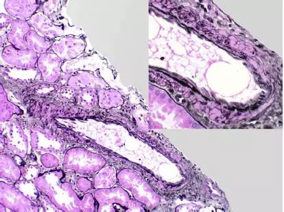 肾毒性的药物排名,肾毒性食物有哪些